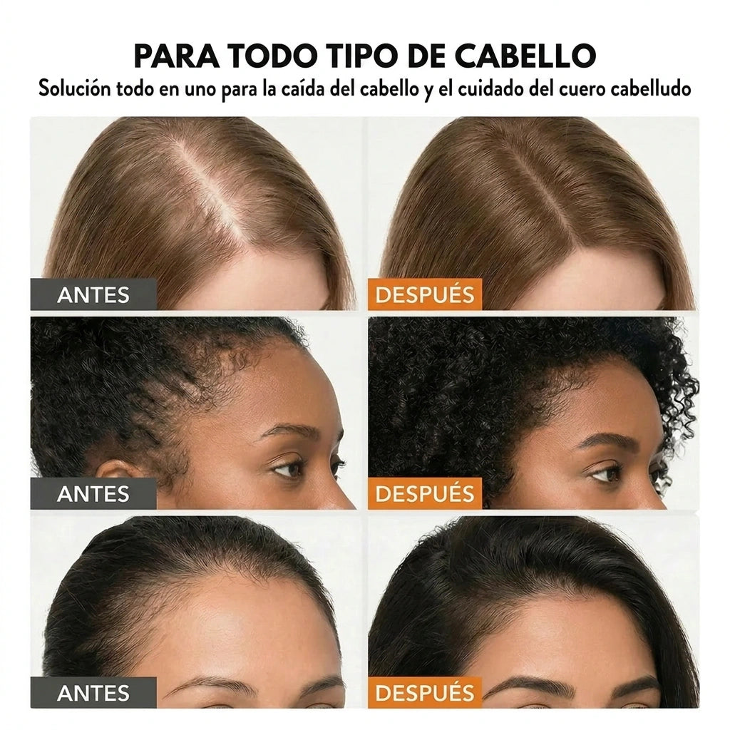 Serum Capilar #1 Korea